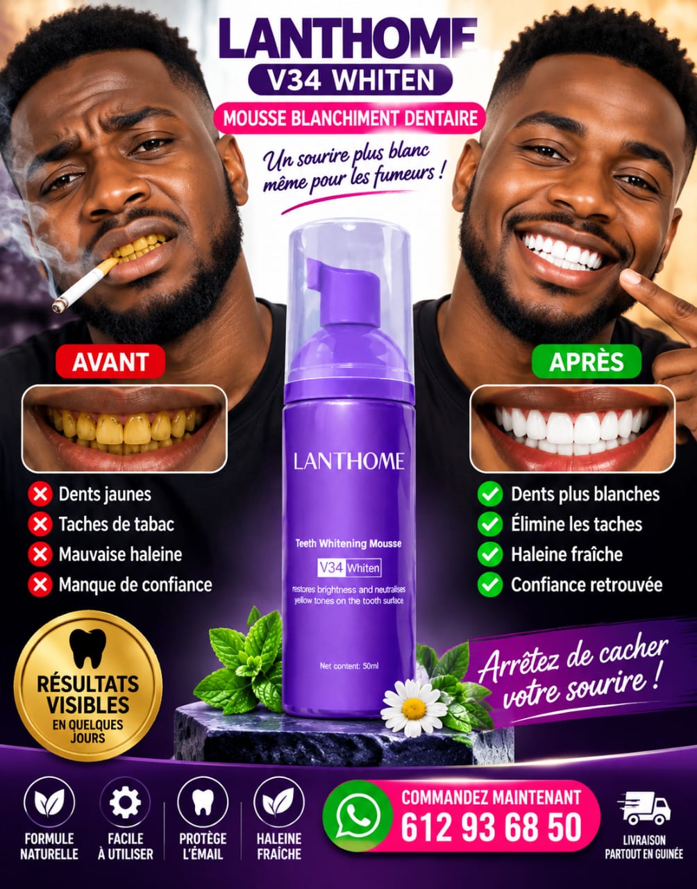 🦷 LANTHOME V34 Whiten – Mousse Dentifrice Blanchissante